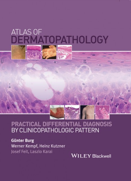 Atlas of Dermatopathology: Practical Differential Diagnosis by Clinicopathologic Pattern