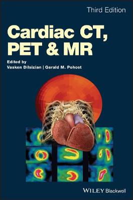 Cardiac CT, PET and MR 3rd edition