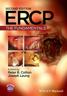ERCP: The Fundamentals 2nd edition