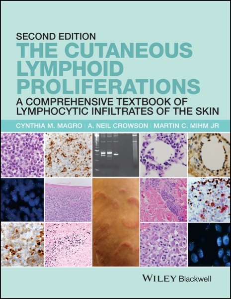 Cutaneous Lymphoid Proliferations - A Comprehensive Textbook of Lymphocytic   Infiltrates of the Skin: A Comprehensive Textbook of Lymphocytic Infiltrates of the Skin 2nd Edition