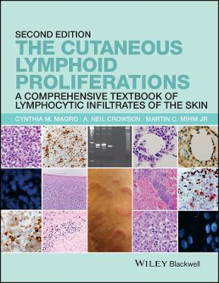 Cutaneous Lymphoid Proliferations: A Comprehensive Textbook of Lymphocytic Infiltrates of the Skin