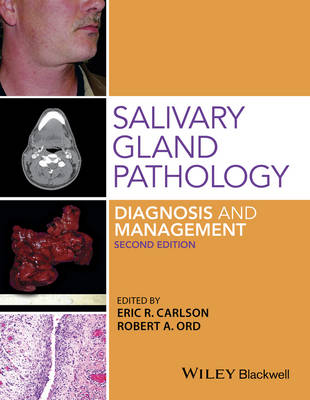 Salivary Gland Pathology: Diagnosis and Management 2nd edition