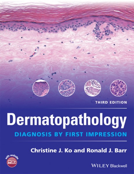 Dermatopathology: Diagnosis by First Impression