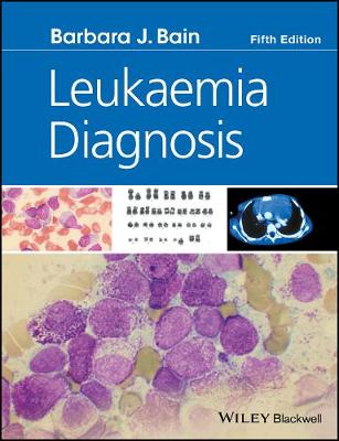 Leukaemia Diagnosis 5e