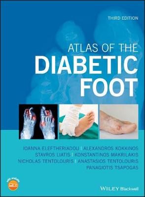 Atlas of the Diabetic Foot, 3rd edition 3rd Edition