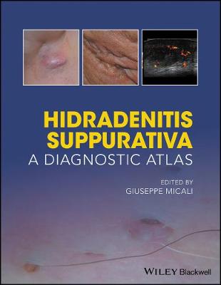 Hidradenitis Suppurativa: A Diagnostic Atlas