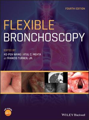 Flexible Bronchoscopy 4th edition