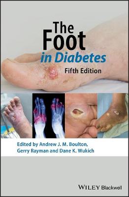 Foot in Diabetes 5th Edition 5th Edition