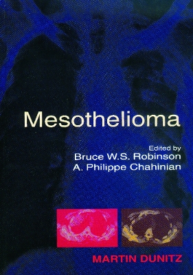 Mesothelioma