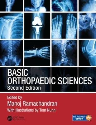 Basic Orthopaedic Sciences 2nd edition