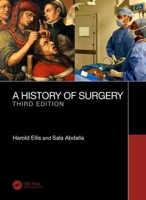 History of Surgery: Third Edition 3rd edition