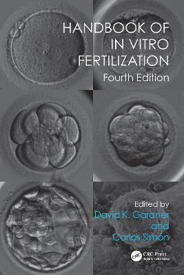 Handbook of In Vitro Fertilization 4th edition