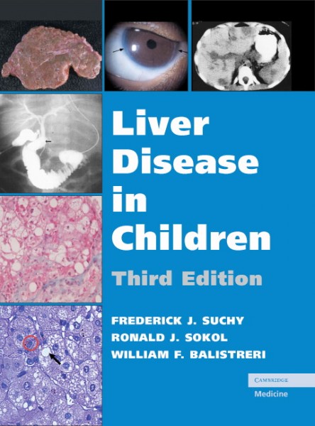 Liver Disease in Children