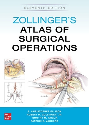 Zollinger's Atlas of Surgical Operations, Eleventh Edition 11th edition