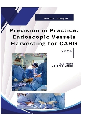 Precision in Practice: Endoscopic Vessel Harvesting for CABG