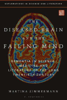 Diseased Brain and the Failing Mind: Dementia in Science, Medicine and Literature of the Long Twentieth Century
