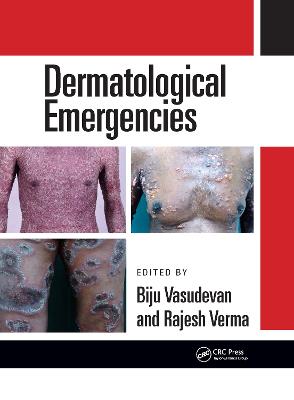 Dermatological Emergencies