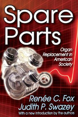 Spare Parts: Organ Replacement in American Society