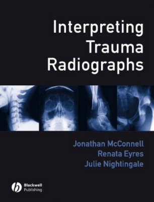 Interpreting Trauma Radiographs illustrated edition