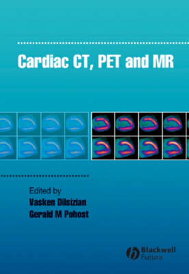 Cardiac CT, PET and MR