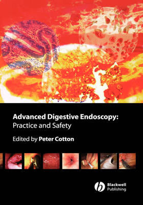 Advanced Digestive Endoscopy: Practice and Safety
