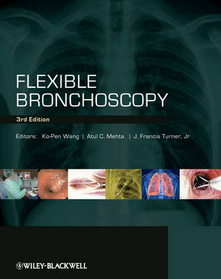 Flexible Bronchoscopy 3rd edition