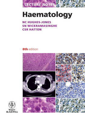 Lecture Notes: Haematology 8th Revised edition
