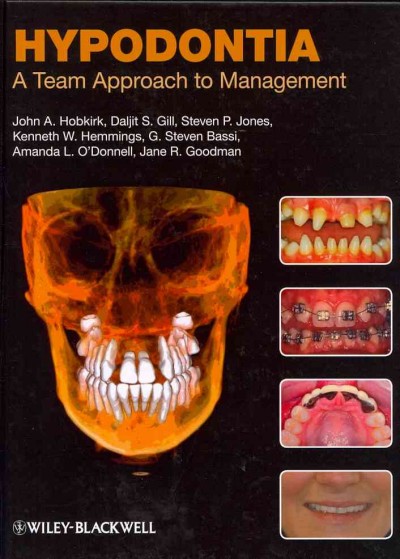 Hypodontia: A Team Approach to Management