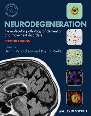 Neurodegeneration: The Molecular Pathology of Dementia and Movement Disorders 2nd edition