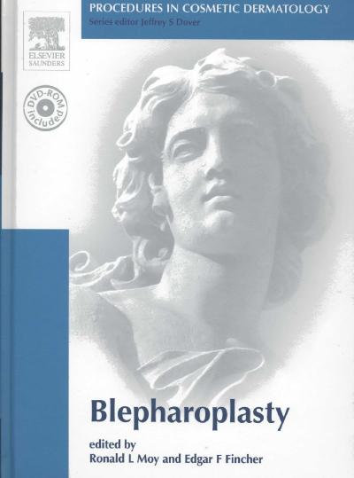 Blepharoplasty