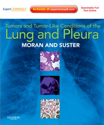 Tumors and Tumor-like Conditions of the Lung and Pleura: Expert Consult: Online and Print