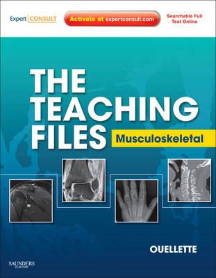 Teaching Files: Musculoskeletal: Expert Consult - Online and Print