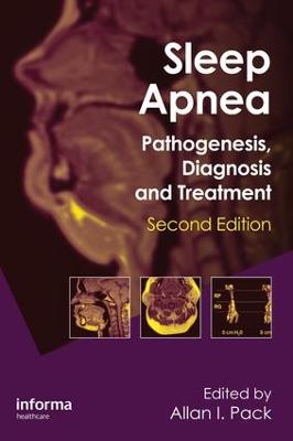 Sleep Apnea: Pathogenesis, Diagnosis and Treatment