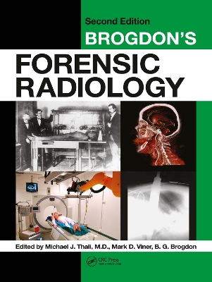 Brogdon's Forensic Radiology 2nd edition
