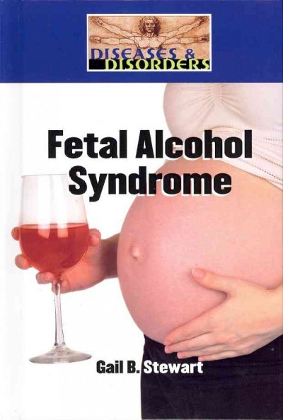 Fetal Alcohol Syndrome