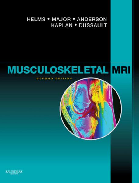 Musculoskeletal MRI E-Book