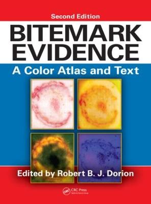 Bitemark Evidence: A Color Atlas and Text, 2nd Edition 2nd edition