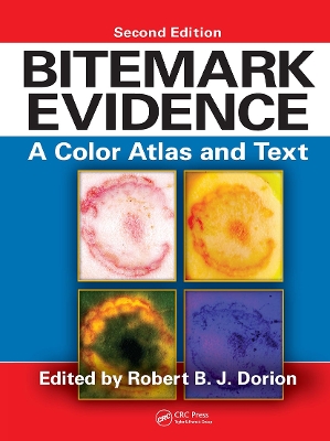Bitemark Evidence: A Color Atlas and Text, 2nd Edition