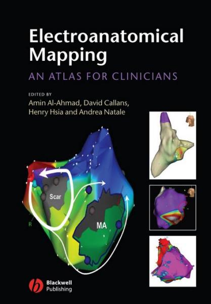 Electroanatomical Mapping: An Atlas for Clinicians