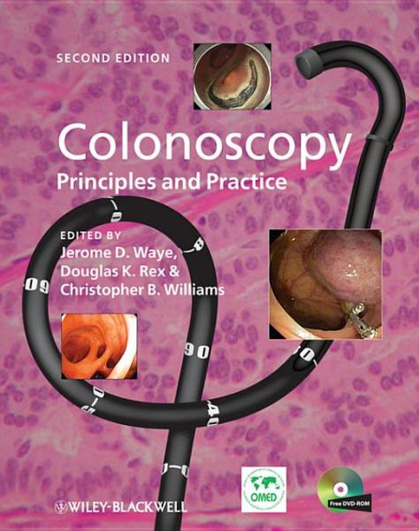 Colonoscopy: Principles and Practice