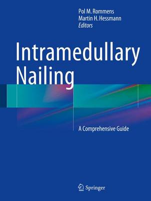 Intramedullary Nailing: A Comprehensive Guide