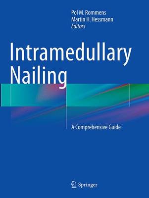 Intramedullary Nailing: A Comprehensive Guide Softcover reprint of the original 1st ed. 2015