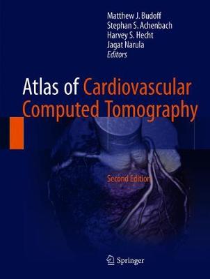 Atlas of Cardiovascular Computed Tomography 2nd ed. 2018