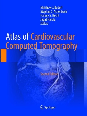 Atlas of Cardiovascular Computed Tomography Softcover reprint of the original 2nd ed. 2018