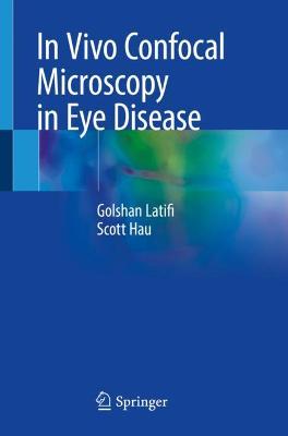 In Vivo Confocal Microscopy in Eye Disease 2022 ed.