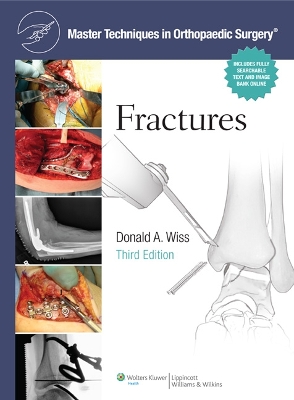 Master Techniques in Orthopaedic Surgery: Fractures 3rd edition