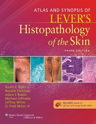 Atlas and Synopsis of Lever's Histopathology of the Skin 3rd edition
