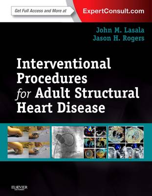 Interventional Procedures for Adult Structural Heart Disease E-Book: Expert Consult - Online