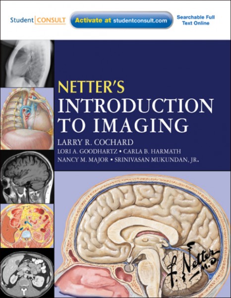 Netter's Introduction to Imaging E-Book: Netter's Introduction to Imaging E-Book