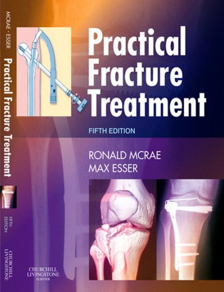Practical Fracture Treatment E-Book: Practical Fracture Treatment E-Book